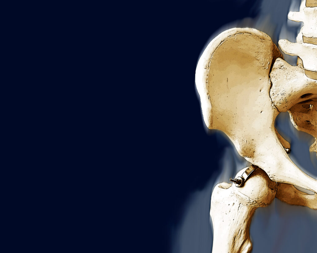 articulación cadera